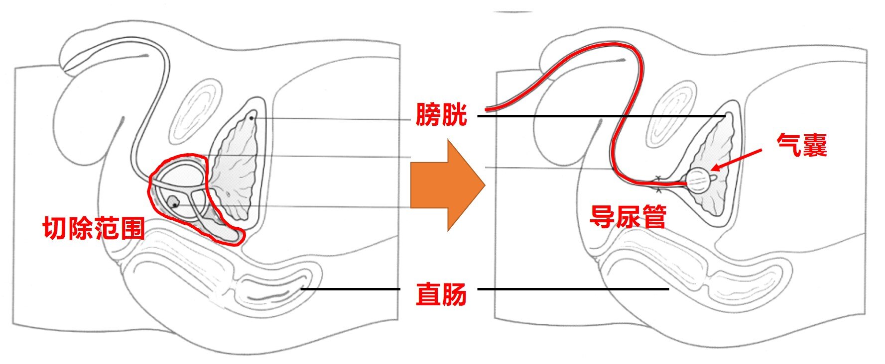 古代故事憋尿小说_古代憋尿的故事_古代被尿憋死的诗人