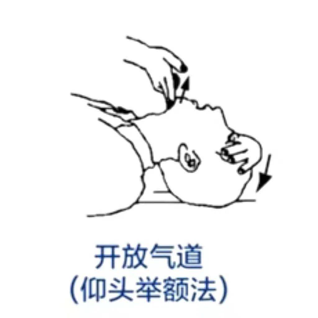 手术办通气后能吃什么_手术后不通气怎么办_手术后通气一般多久