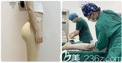 抽脂后多久可以玩手机游戏_手臂吸脂可以玩手机吗_大腿抽脂后多久可以啪