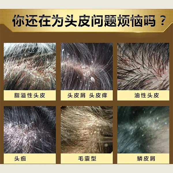苹果下载软件需要验证显示不出来_苹果手机下载软件显示需要验证_苹果下载软件需要验证显示不出来