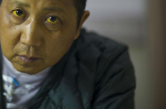肝病患者能长时间玩手机吗_乙肝能玩手机吗_肝炎可以玩手机游戏吗