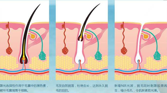 拔毛手机游戏软件_拔毛的手机游戏_拔毛游戏攻略