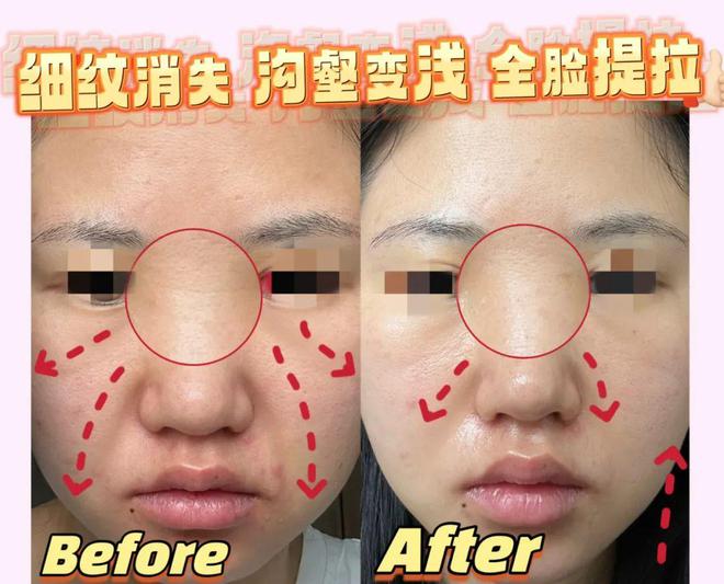 支架手机游戏_MRP游戏手机支架_手机游戏支架推荐